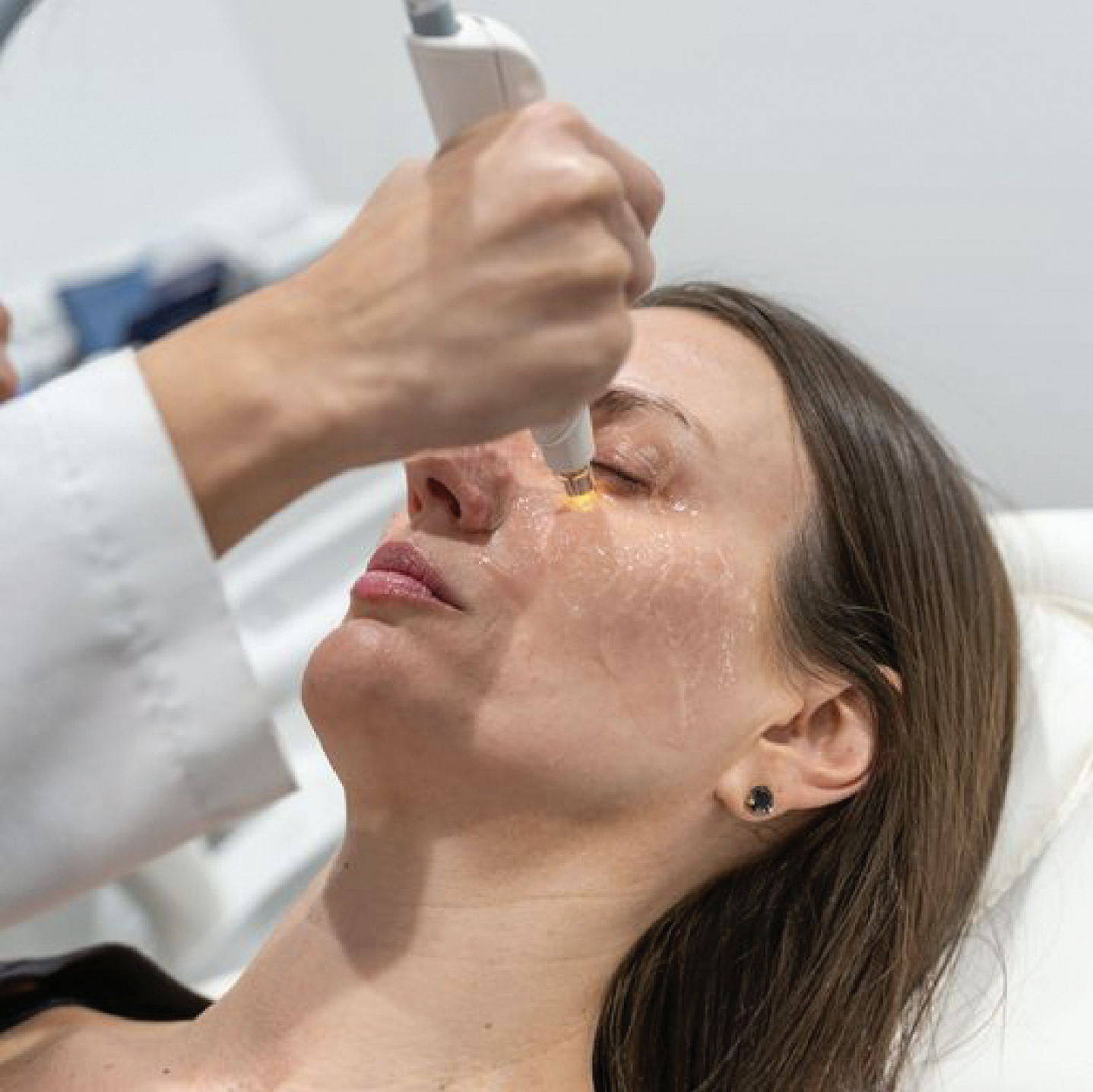 A literature review including 13 studies found that intense pulsed light therapy—ranging from two to four sessions—led to a clinically relevant reduction in dry eye symptoms when compared to placebo (-16 OSDI points).
